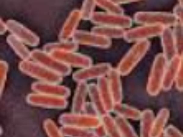 Suspected Russian plague case unlikely to become another COVID-19 - Medical Expert