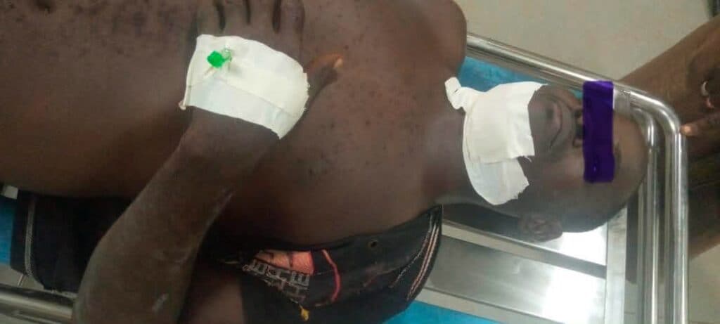 One killed, 6 injured as Sagnarigu MUSEC imposes curfew after clashes in Damankungyili-Nyeshie